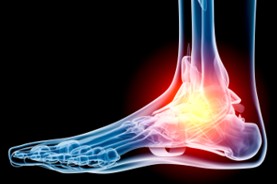 alberta plantar fascia treatments